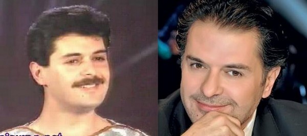 Arab Celebrities Before After